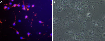 Expression of Nogo receptor in rat cerebellar granule