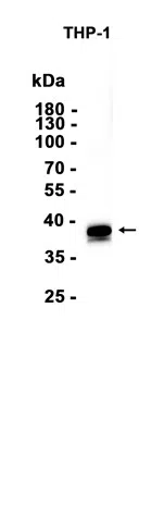 AMRe86574