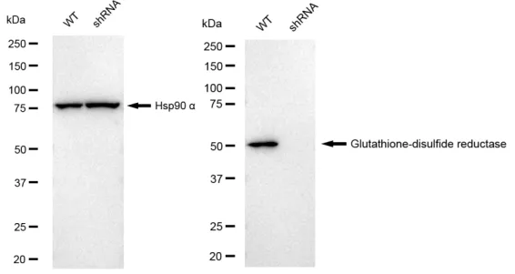 KVAb01525