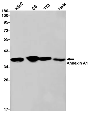 AMRe01649