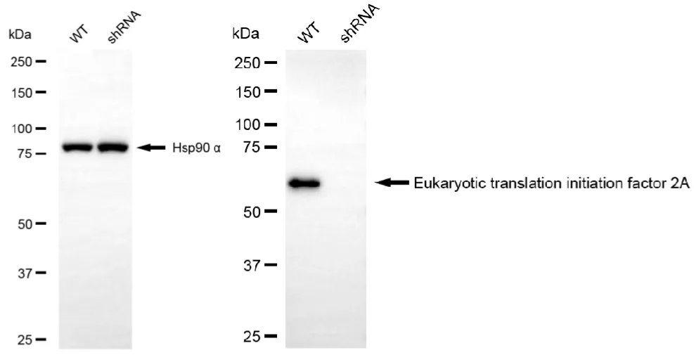 KVAb01120