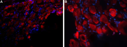 Expression of P2RX3 in rat DRG