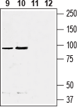 Western blot analysis of rat (lanes 9 and 11) and mouse (lanes 10 and 12) fat tissue lysate: