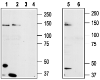 Western blot analysis of prostate carcinoma cell lines DU145 (lanes 1 and 3), Human L NCa P prostate carcinoma (lanes 2 and 4) and mouse-TRPM8 transfected HEK-293 (lanes 5 and 6) ce
