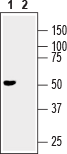 Western blot analysis of mouse brain lysate: