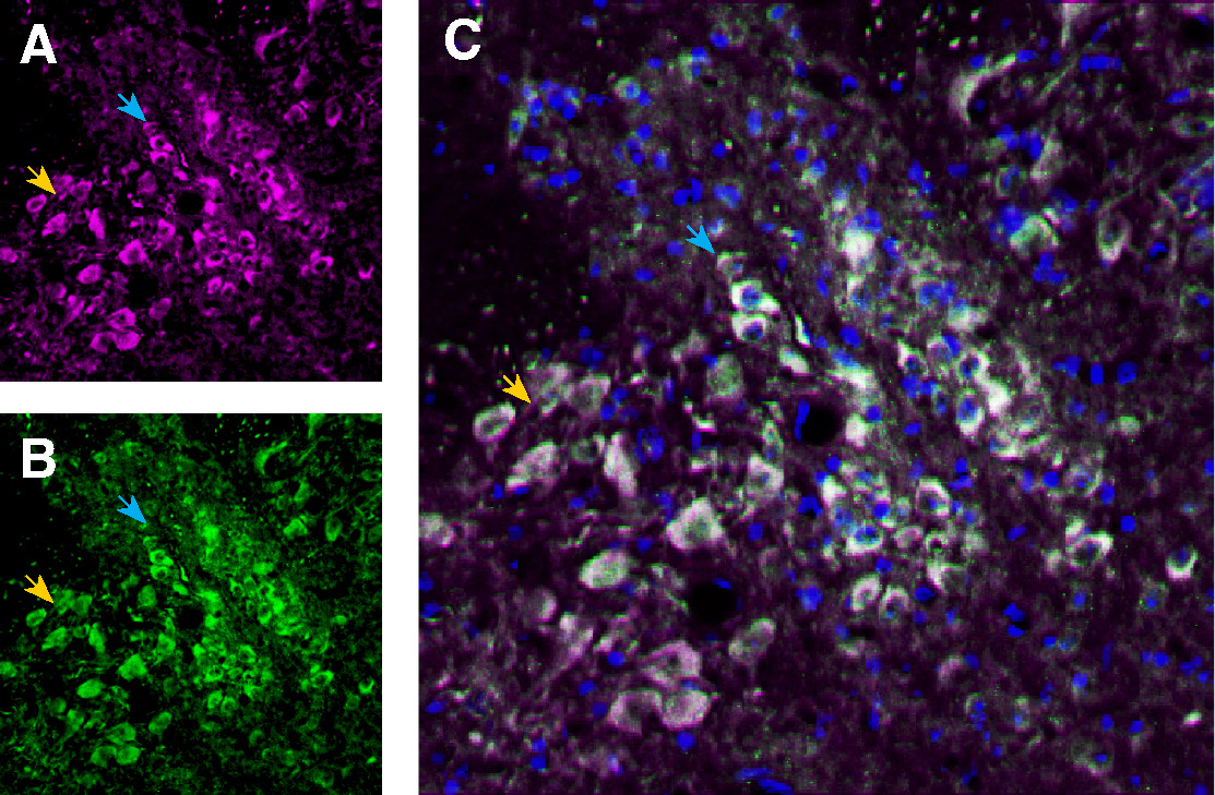 Multiplex staining of TRPV1 and Neurokinin 1 Receptor (NK1R) in mouse dorsal raphe nucleus: