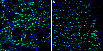 Expression of NR2A in mouse brain sections