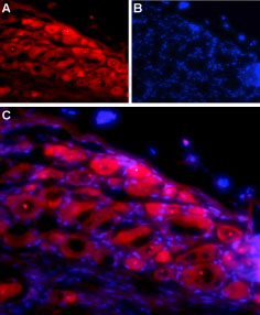 Expression of NLGN1 in rat DRG