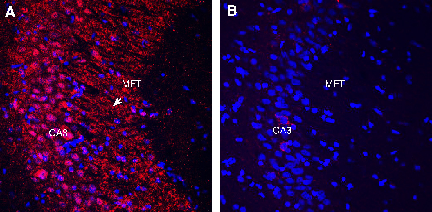Expression of Gephyrin in rat hippocampus