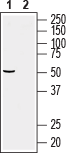 Western blot analysis of mouse liver membrane: