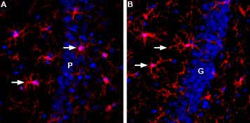 Expression of IBA1/AIF1 in rat brain
