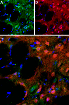 Expression of D 5 dopamine receptor in rat striatum