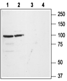 Western blot analysis of rat (lanes 1 and 3) and mouse (lanes 2 and 4) brain lysates: