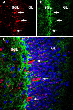 Multiplex staining of NMDAR1 and ASCT1 in mouse hippocampus