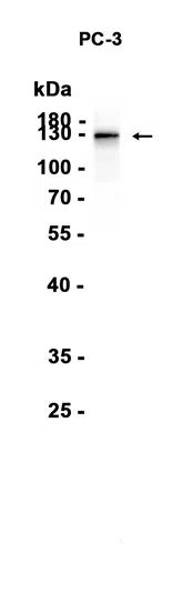 AMRe86730