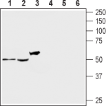 Western blot analysis of rat DRG (lanes 1 and 4), mouse brain (lanes 2 and 5) and human brain neuroblastoma SH-SY5Y (lanes 3 and 6) lysates: