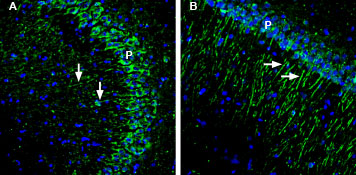 Expression of GIPC1 in mouse and rat hippocampus