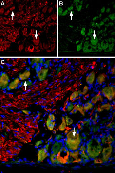 Multiplex staining of VGLUT2 and Neurokinin 1 Receptor in rat DRG