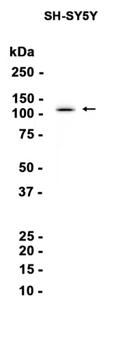 AMRe87073