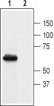Western blot analysis of rat brain membranes: