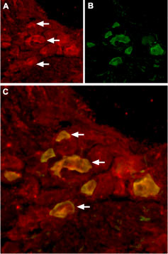 Expression of TRPV6 in rat DRG