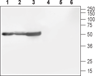 Western blot analysis of rat brain (lanes 1 and 4), mouse brain (lanes 2 and 5) and rat cortex (lane 3 and 6):