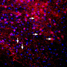Expression of K ir 3.2 in mouse brain