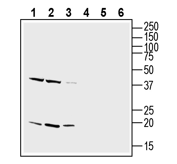 Western blot analysis of rat brain lysate (lanes 1 and 4), mouse brain lysate (lanes 2 and 5) and mouse liver lysate (lanes 3 and 6):