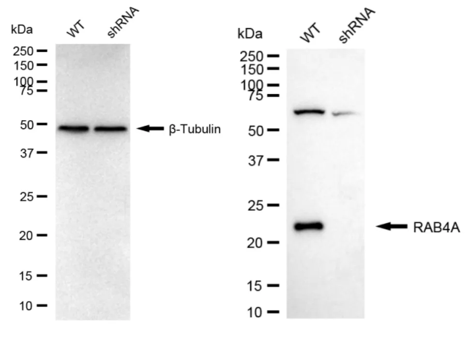KVAb00972