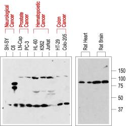 Western blot analysis of normal rat tissue (right) and in human cancer cell lines (left):