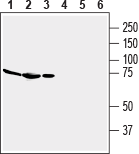 Western blot analysis of mouse brain membranes (lanes 1 and 4), rat brain lysate (lanes 2 and 5) and rat spleen membranes (lanes 3 and 6):