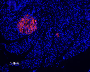 Expression of P2X7 Receptor in rat pancreas