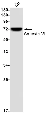 AMRe01445