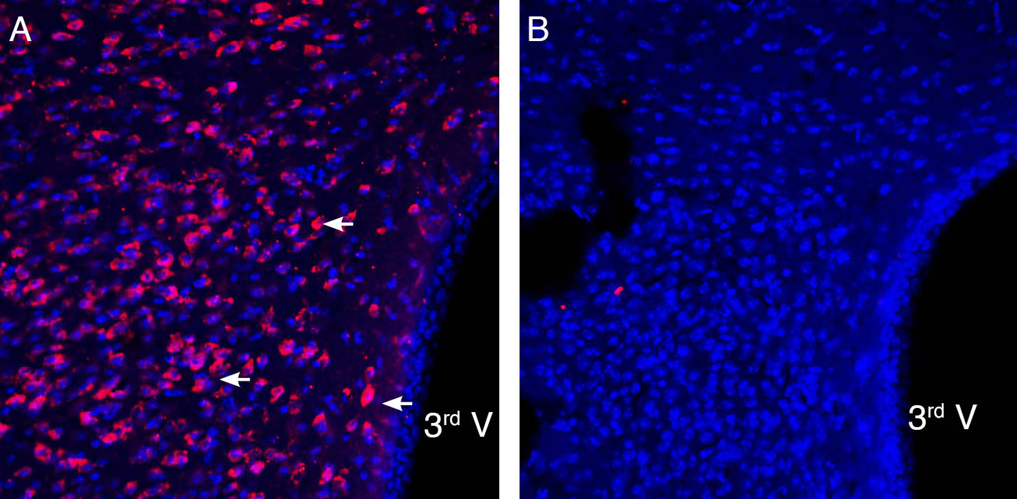 Expression of P2X3 in mouse paraventricular nucleus of the hypothalamus (PVN).