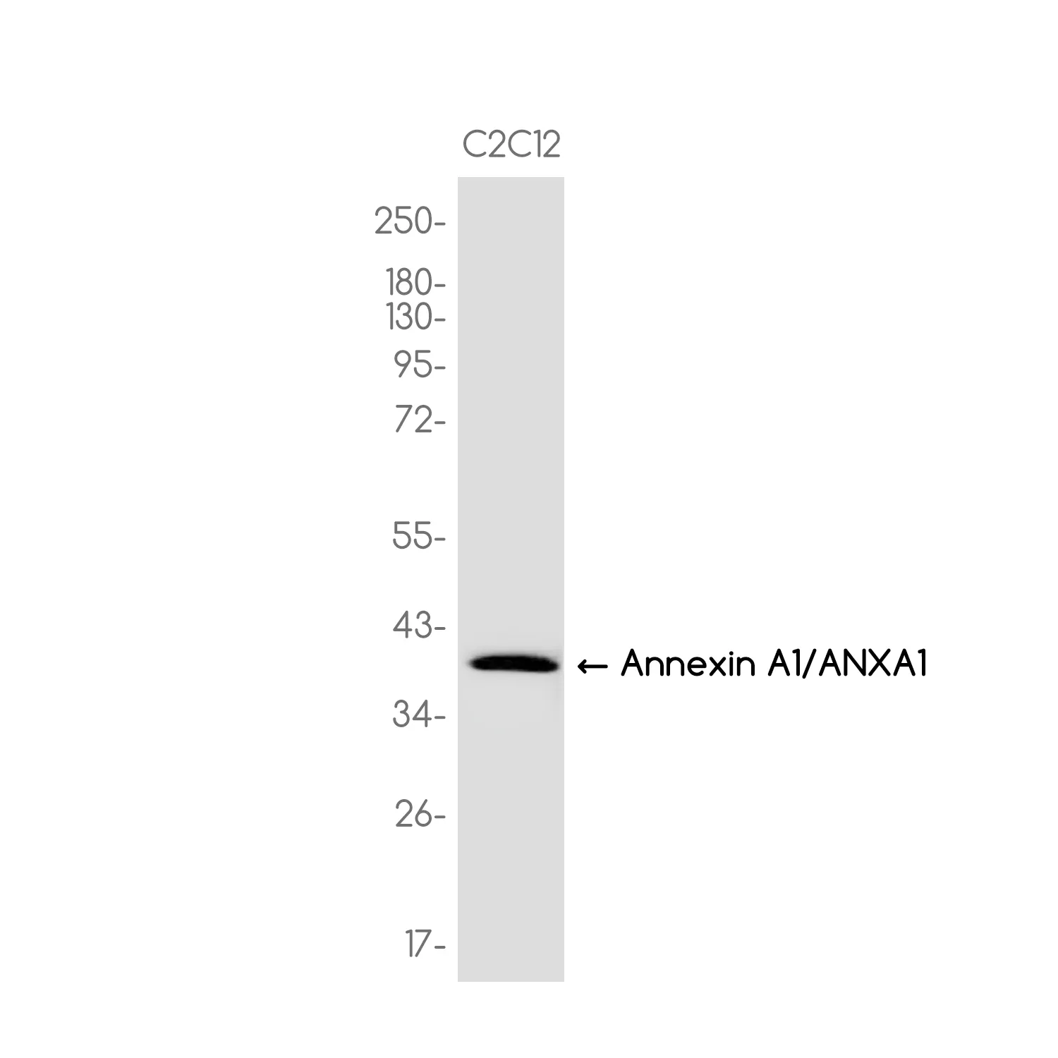 AMRe03988