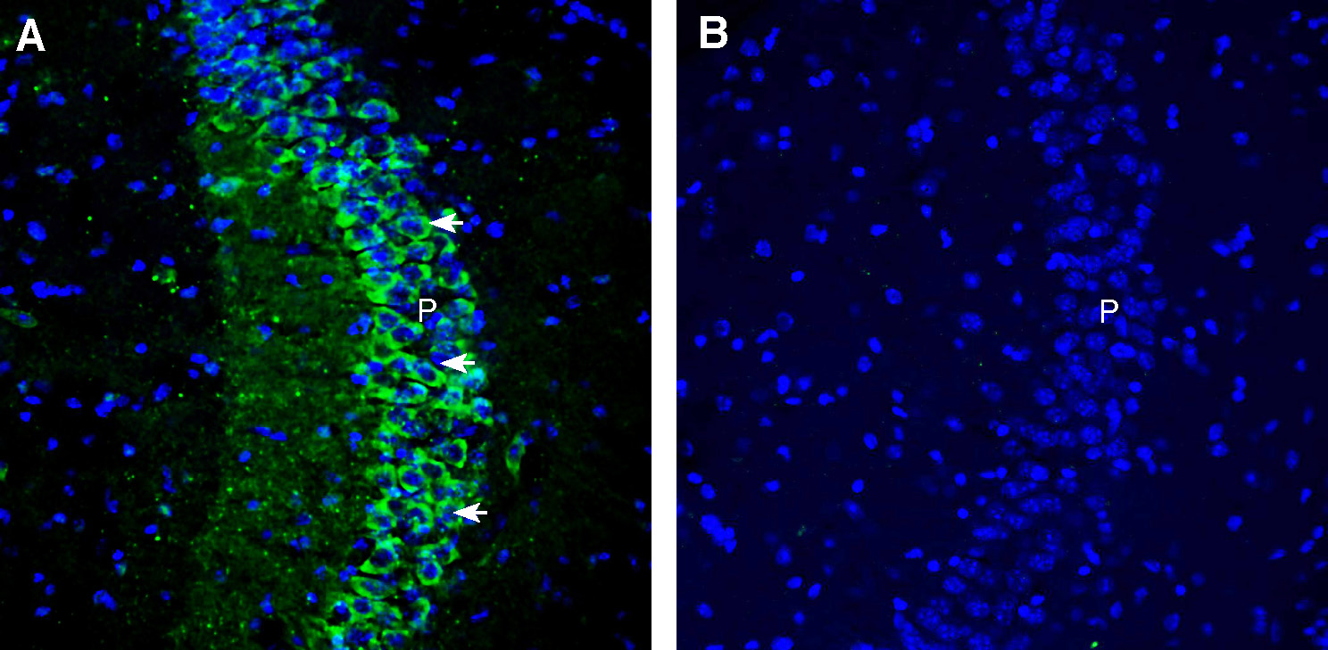 Expression of Ca V β2 in mouse hippocampus.