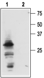 Western blot analysis of mouse submandibular glands (SMGs):