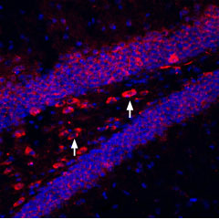 Expression of K ir 6.2 in mouse hippocampus