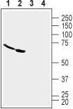 Western blot analysis of human U-87 MG glioblastoma cell line lysate (lanes 1 and 3) and human Malme-3M melanoma cell line lysate (lanes 2 and 4) :