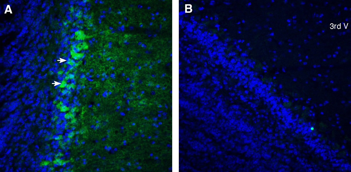 Expression of CXCR7 in mouse olfactory bulb.
