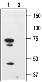 Western blot analysis of human melanoma cells A875: