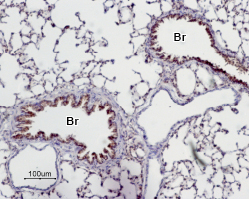 Expression of Adenosine A 2A Receptor in rat lung