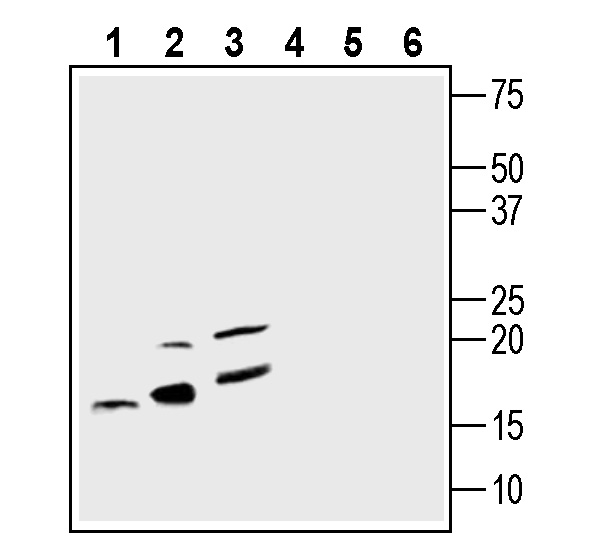 Western blot analysis of rat spleen lysate (lanes 1 and 4), mouse spleen membranes (lanes 2 and 5) and mouse BV-2 microglia cell line lysate (lanes 3 and 6):
