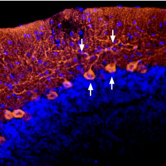 Expression of AGTR1 in rat cerebellum