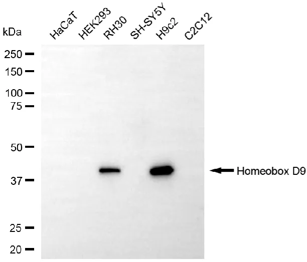 KVAb00353