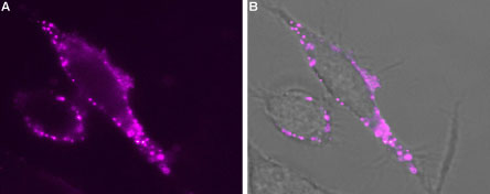 Expression of TRPV 3 in rat PC12 cells