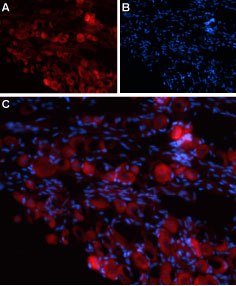 Expression of TRPV4 in rat DRG