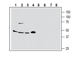 Western blot analysis of human MCF-7 breast adenocarcinoma (lanes 1 and 5), human Colo-205 colorectal adenocarcinoma (lanes 2 and 6), human PANC-1 pancreas ductal adenocarcinoma (lanes 3 and 7) and human Malme-3M melanoma cell line lysate (lanes 4 and