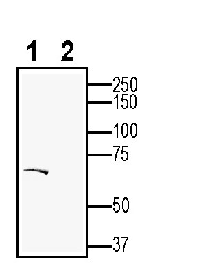 Western blot analysis of rat brain membranes: