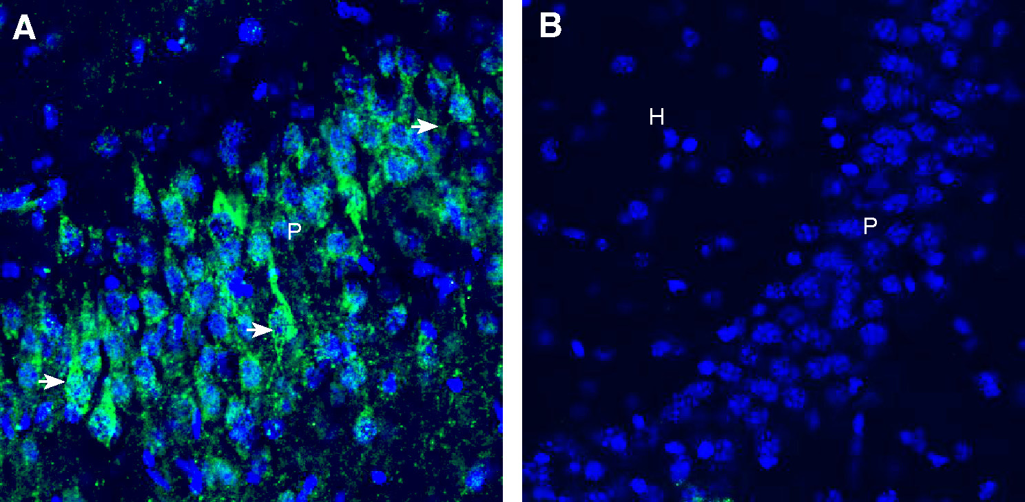 Expression of CD9 in mouse hippocampus.